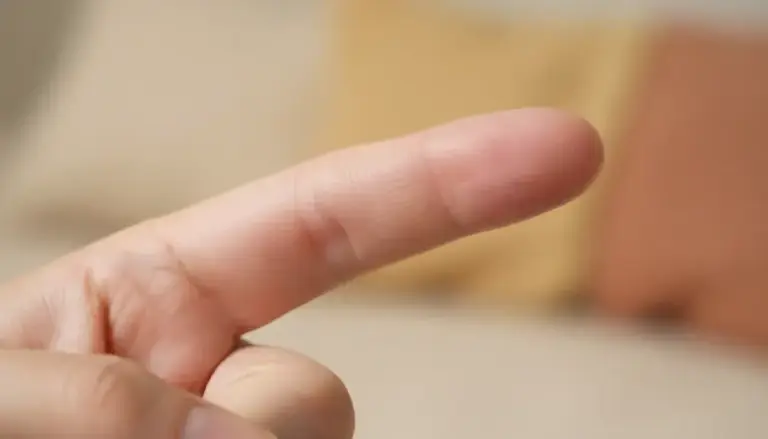 Jak Zmniejszyć Opuchliznę Palca?